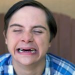 4 dicas para a saúde bucal na trissomia 21