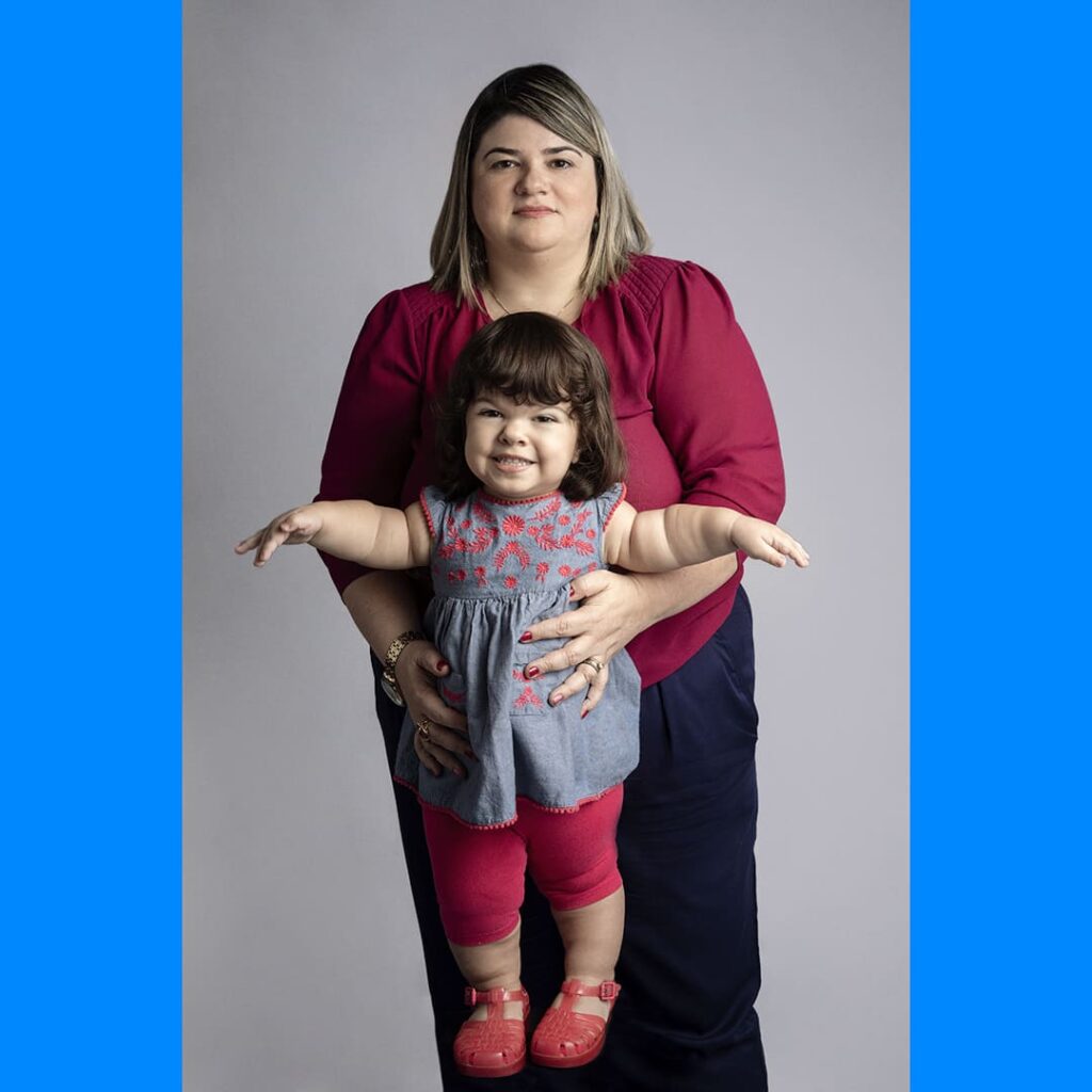 Foto de mãe e filha, que tem acondroplasia.