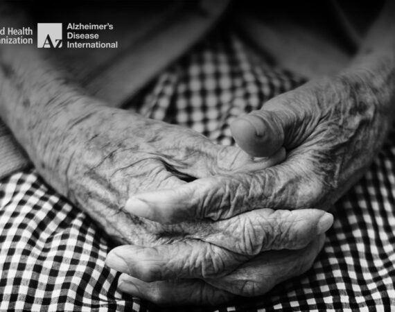 Fotografia em preto e branco, mostra em detalhes as mãos de uma pessoa idosa, com os dedos entrelaçados, acima das pernas, ilustrando a Comunidade Amiga da Pessoa com Demência.