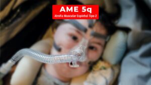 Foto desfocada, de criança com atrofia muscular espinhal, ilustrando notícia sobre ampliação do tratamento da AME no SUS.
