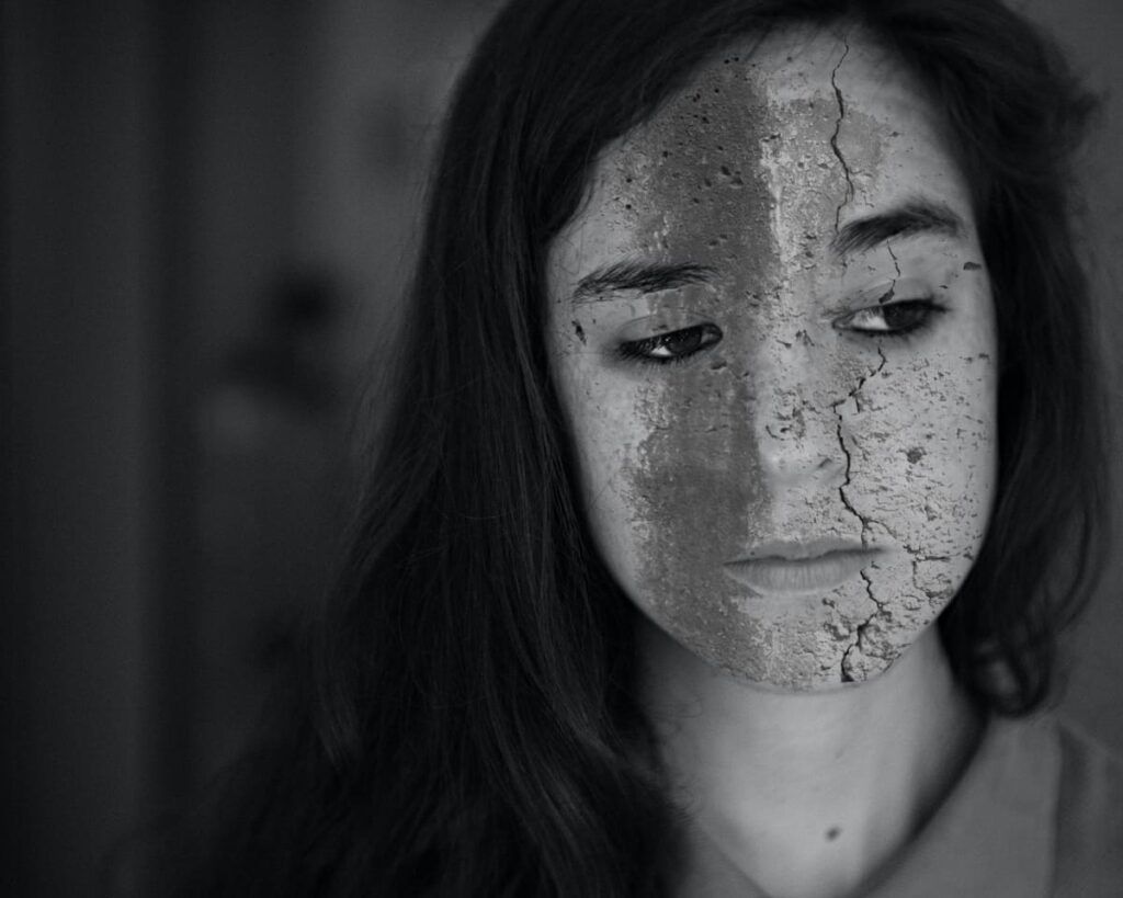 Foto em preto e branco do rosto de mulher com olhar de tristeza, para ilustrar os 5 benefícios do tratamento da bipolaridade.
