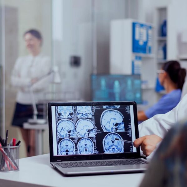 A imagem em um consultório médico com um laptop exibindo varreduras cerebrais, de pacientes com epilepsia que aguardam por terapia no SUS.